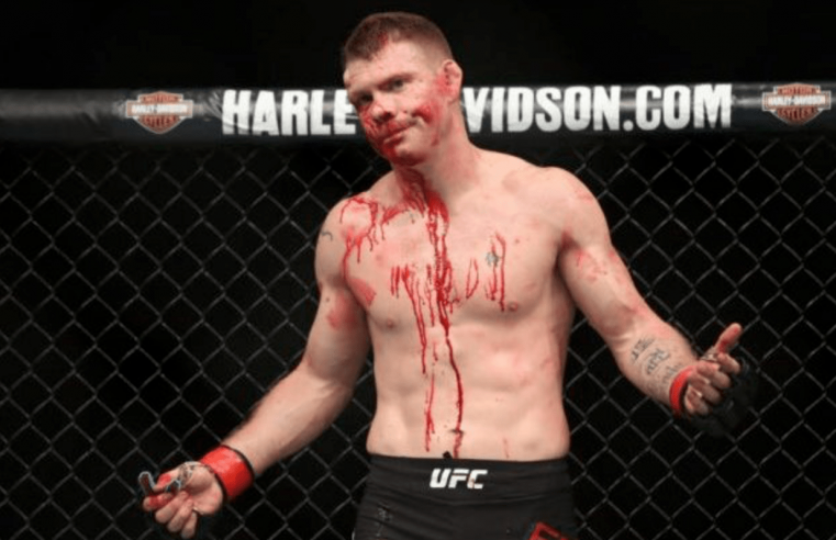 UFC: Paul Felder Posts Several Explicit Photos Of His Past Injuries