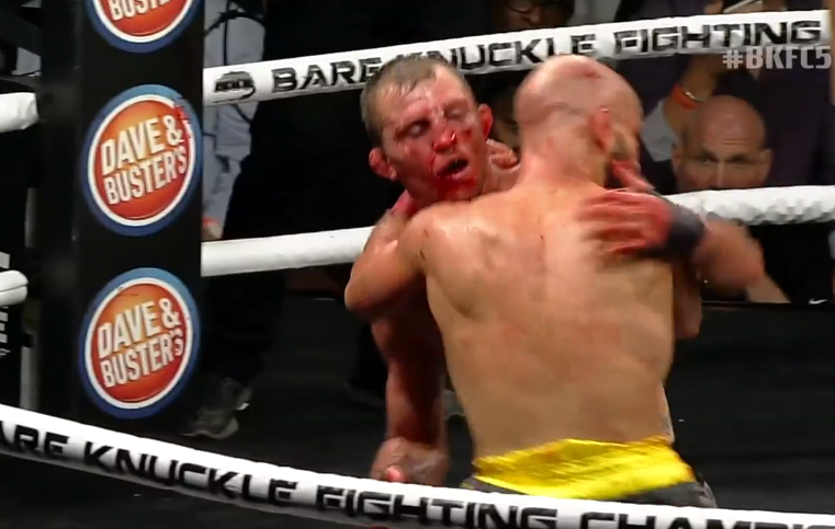 Graphic: Artem Lobov And Jason Knight Battered And Bruised After Their Fight