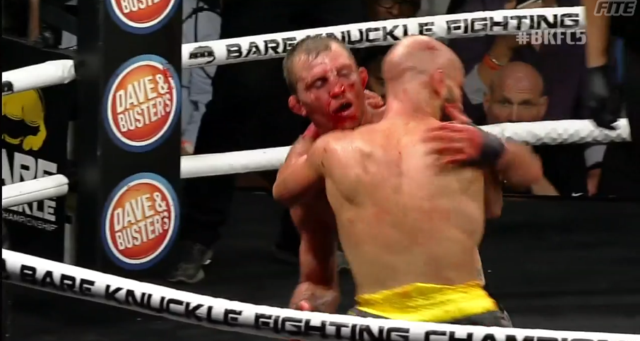 Graphic: Artem Lobov And Jason Knight Battered And Bruised After Their Fight